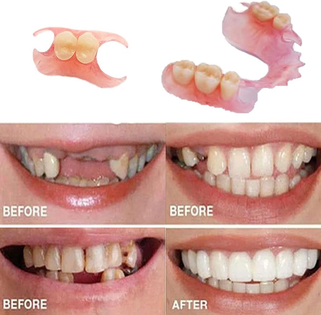 Making Temporary Partial or Full Dentures Tooth Fixing Kit for Improving Condident Smile