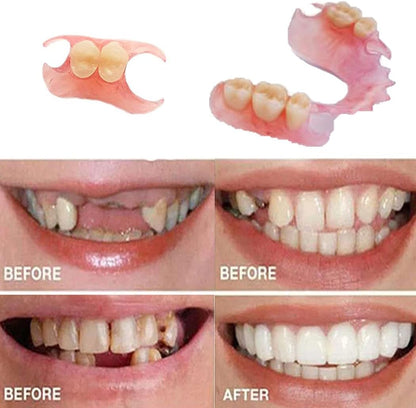 Making Temporary Partial or Full Dentures Tooth Fixing Kit for Improving Condident Smile